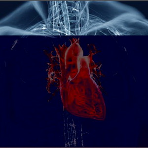 cardiovascular_system_image_99837.jpg